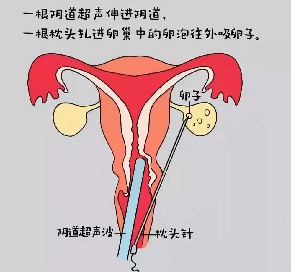 子宫异常可以通过试管成功怀上宝宝吗？