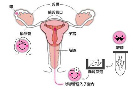 试管备孕前，你知道男性吃什么补精子最快吗？